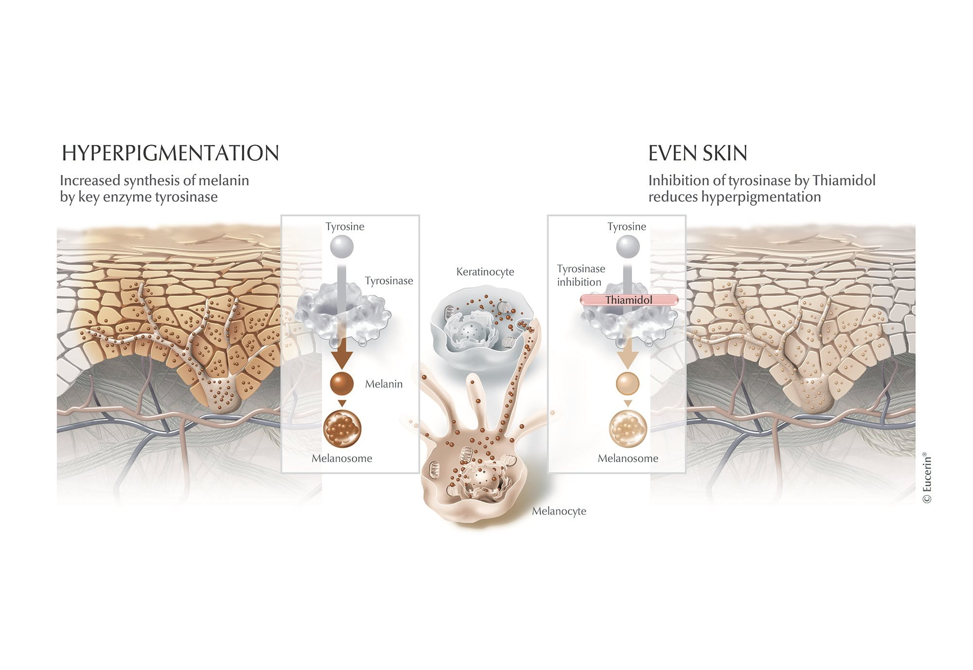 What is Thiamidol and How Does it Work? | Eucerin UK